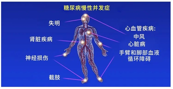 糖尿病是遗传病吗？改善饮食生活习惯是硬道理东源医疗助你实现糖尿病“逆转”